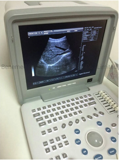 Portable B/W Ultrasound Scanner with Clear Image Quality