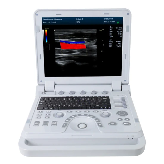 Attrezzature ospedaliere Contec Farbdoppler-Ultraschall-Diagnosesystem