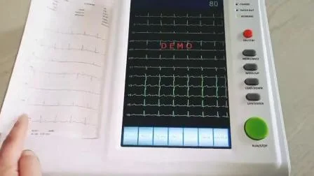 Macchina ECG a 12 canali con schermo a colori, monitor Holter portatile, 3, 6, 12 canali individuali