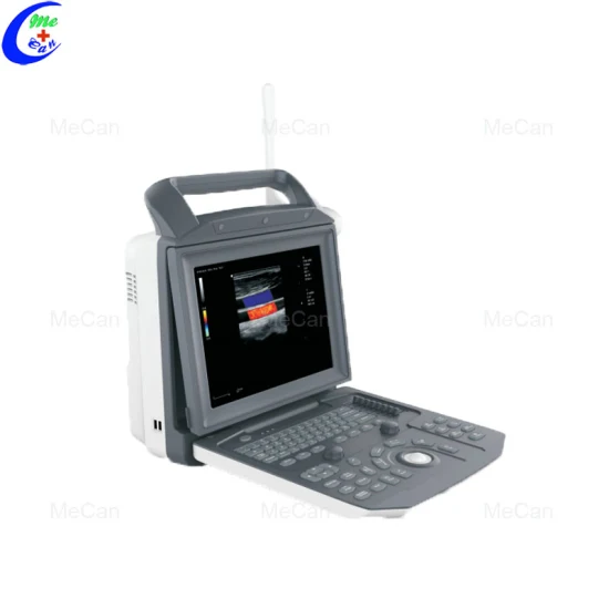 Dispositivo portatile per scanner ad ultrasuoni color Doppler 4D completamente digitale