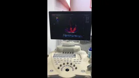 Scanner ecografico per scanner ecografico Color Doppler per carrello 4D economico per diagnosi clinica